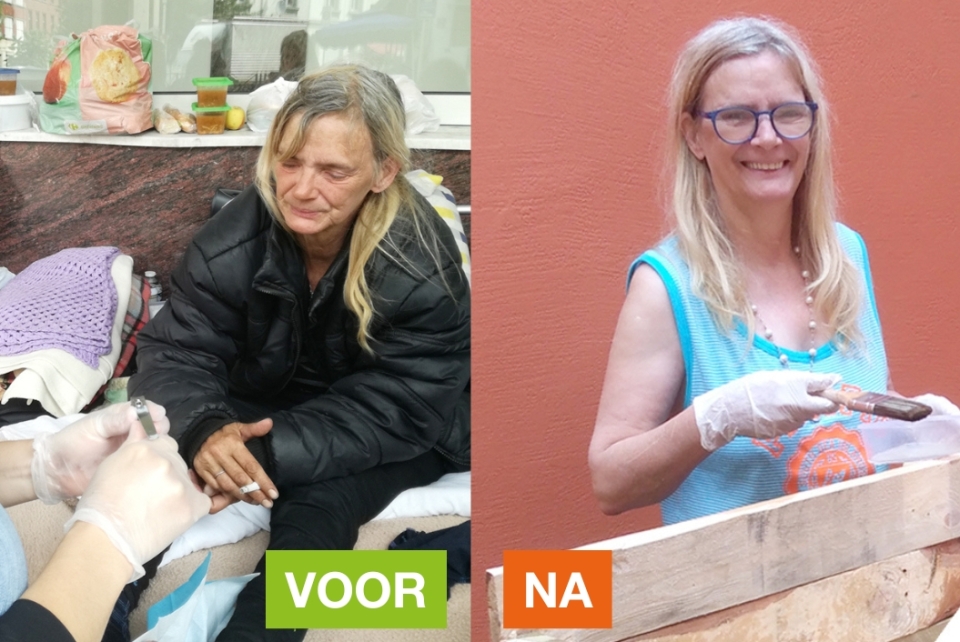 Voor - na patiënte